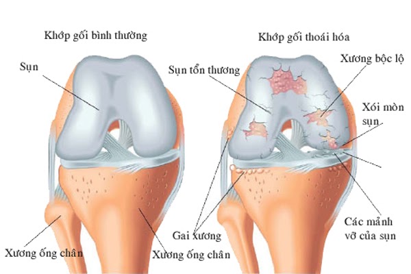 thk1