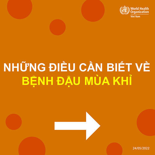 Những điều cần biết về bệnh đậu mùa khỉ