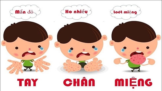 Nhiều biến chứng nguy hiểm từ bệnh tay chân miệng.