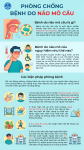 Tờ rơi: Phòng chống bệnh do não mô cầu